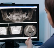 Dental Health Care: What Foods Can Damage Your Teeth?