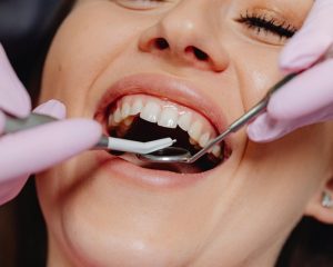 What Are the Signs That You Need a Night Guard for Teeth Grinding?