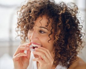 How Invisalign Works on Different Types of Dental Issues