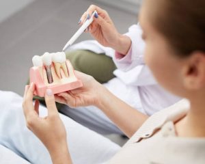 Choosing a Dental Implant Provider: Key Qualifications and Experience Needed Choosing a Dental Implant Provider: Key Qualifications and Experience Needed