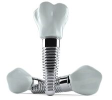 Top Questions to Ask Your Dentist Before Getting Dental Implants