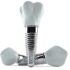 Top Questions to Ask Your Dentist Before Getting Dental Implants